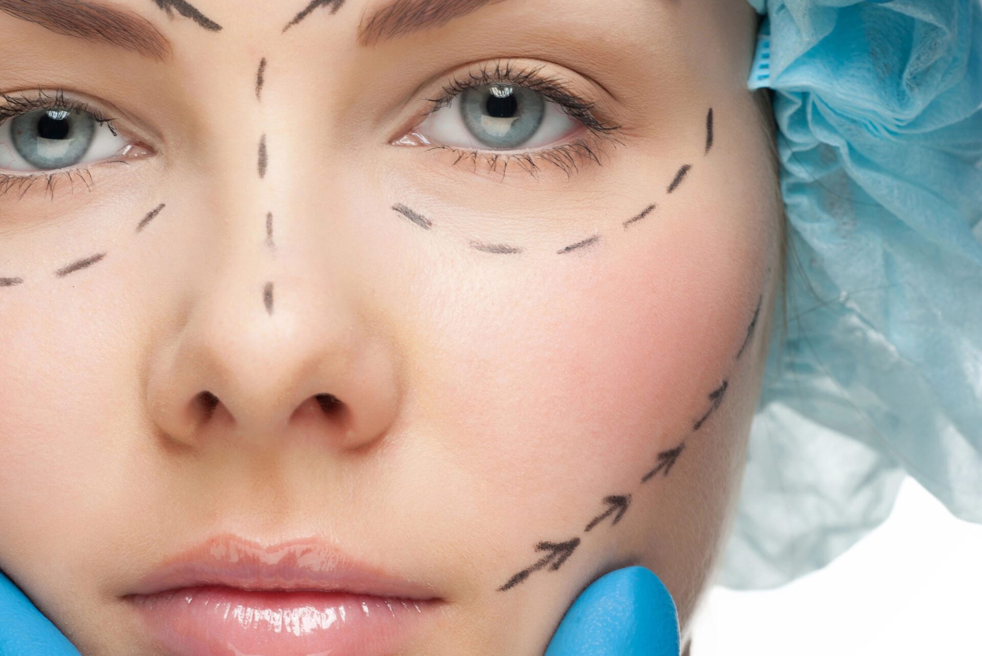 Beautiful young woman with perforation lines on her face before plastic surgery